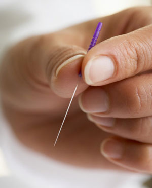 acupuncture needle